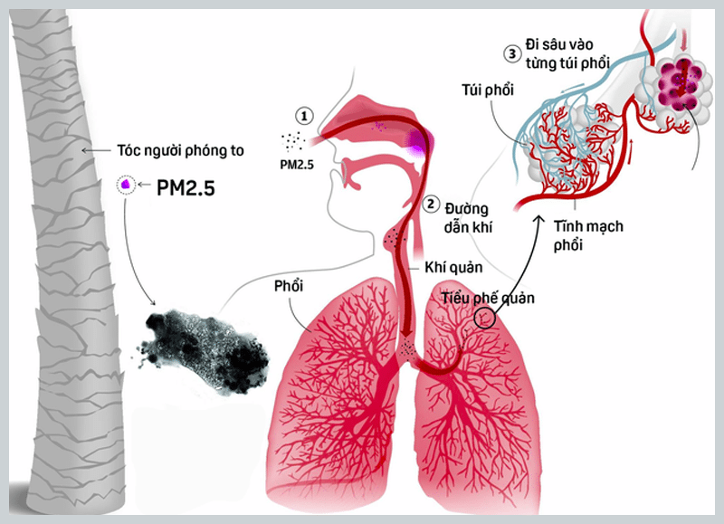 Bụi PM2.5 là tác nhân ô nhiễm ảnh hưởng nhất đối với sức khỏe