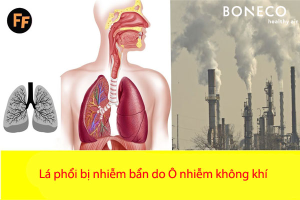 Ô nhiễm không khí gây bệnh ung thư phổi