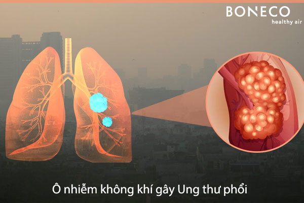 Ô nhiễm không khí gây bệnh Ung thư phổi